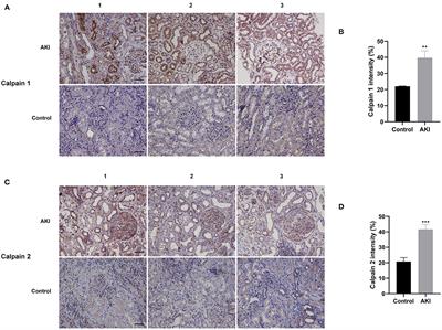 Calpain Inhibitor Calpeptin Alleviates Ischemia/Reperfusion-Induced Acute Kidney Injury via Suppressing AIM2 Inflammasome and Upregulating Klotho Protein